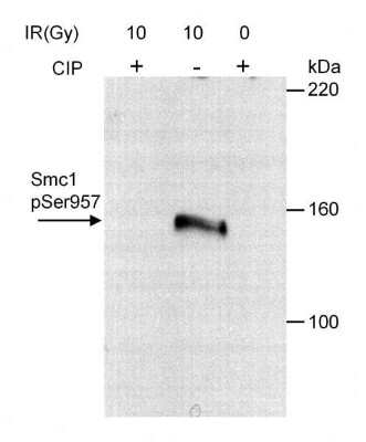 Western Blot: SMC1 [p Ser957] Antibody [NB100-205]